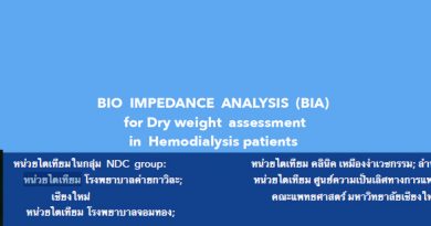 BIO IMPEDANCE ANALYSIS (BIA) for Dry weight assessment in Hemodialysis patients